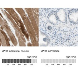 JPH1 Antibody, Novus Biologicals:Antibodies:Primary Antibodies